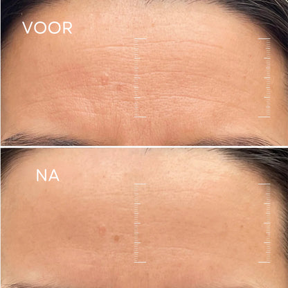 PURGLOWLAB™ Koriaans Bio-Collageen masker